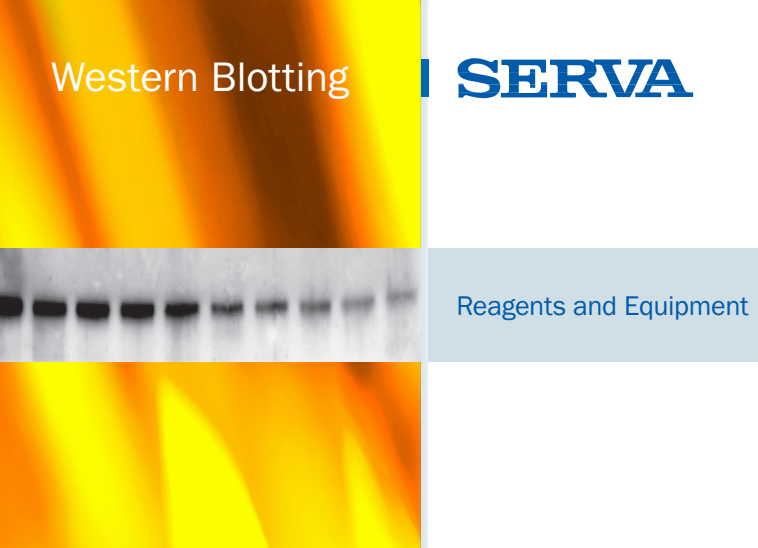 HỆ THỐNG WESTERN BLOT